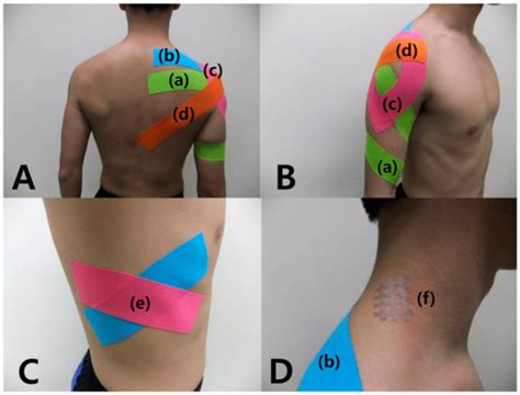 Medicina Free Full Text Effect Of Balance Taping Using Kinesiology