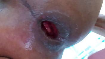 My Anal Play XVIDEOS