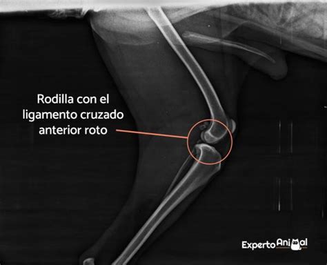 Robar A Entrega Maravilla Rotura De Ligamento Cruzado Anterior En