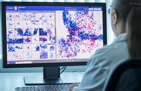 How Hologic Tapped Ai And Volumetric Imaging For Cytology