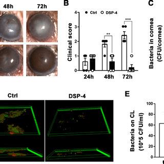 Norepinephrine Aggravated Corneal Inflammation Of P Aeruginosa Induced