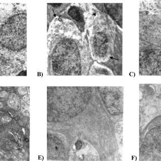 Transmission Electron Micrographs X Of Rat Retina From Control