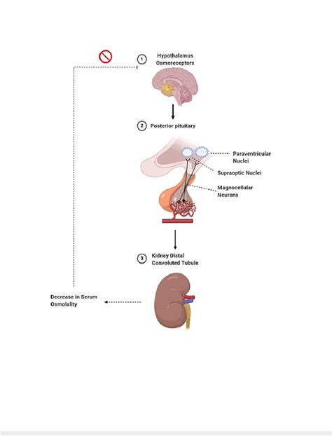 Osmoreceptors In The Hypothalamus Detect Increased Serum Osmolality