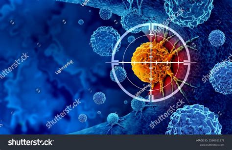 Cancer Detection Screening Treatment Malignant Cells Stock Illustration 2280911871 Shutterstock