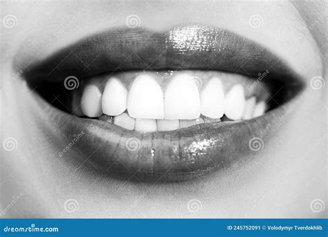 Laughing Woman Mouth with Great Teeth. Perfect Smile after Bleaching ...