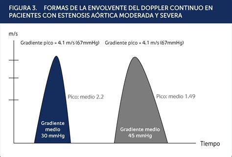 Estenosis AÓrtica Severa Nueva AproximaciÓn DiagnÓstica Revista