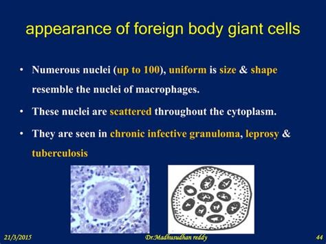 Giant cell formation and function ppt