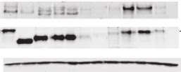 Construction Of Hiv Cytoplasmic Tail Truncation Mutants The Mutants