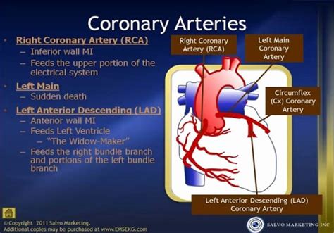 Stemi Nstemi Flashcards Quizlet