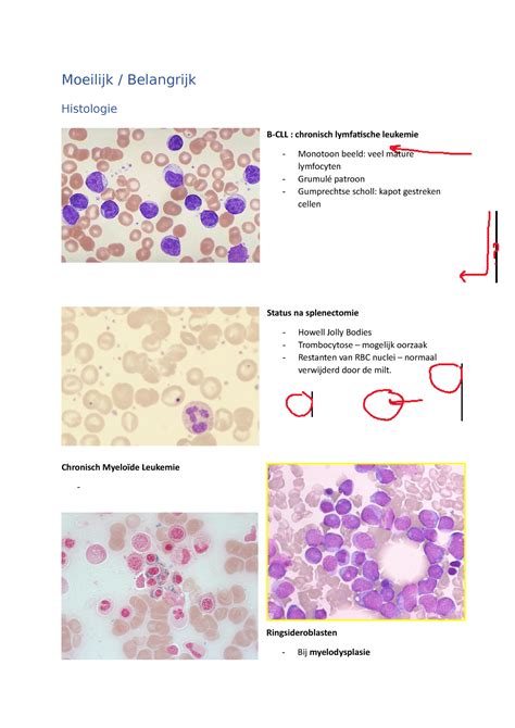 Moeilijk Hematologie En Oncologie Moeilijk Belangrijk Histologie B