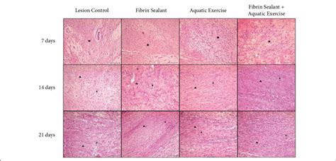 Representative He Histological Aspect Granulation Tissue Download Scientific Diagram