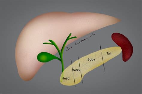 Pancreatic Cancer Treatment In Singapore | LS Lee Surgery Clinic