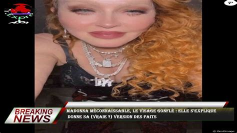 Madonna M Connaissable Le Visage Gonfl Elle S Explique Donne Sa