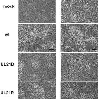 Plaque Formation By Ul D In Vero And A Cells Vero Or A Cells