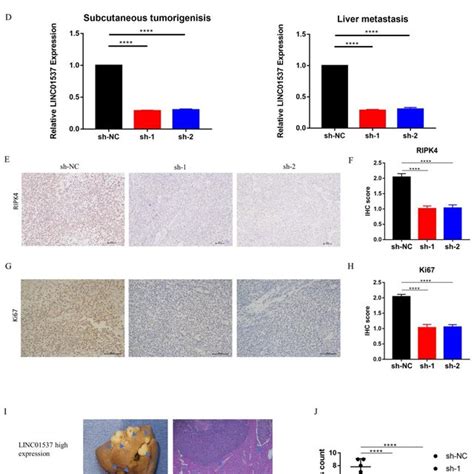 Linc Promotes The Tumor Growth And Metastasis Of Gc In Vivo Bgc