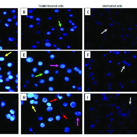 Nuclear Staining Of Mcf 7 Cells By Hoechst 33258 Dye Cells Were Left Download Scientific