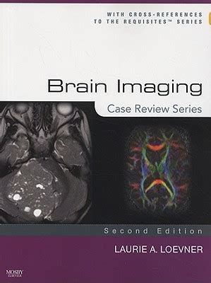 Brain Imaging Case Review Series By Laurie A Loevner Md Goodreads