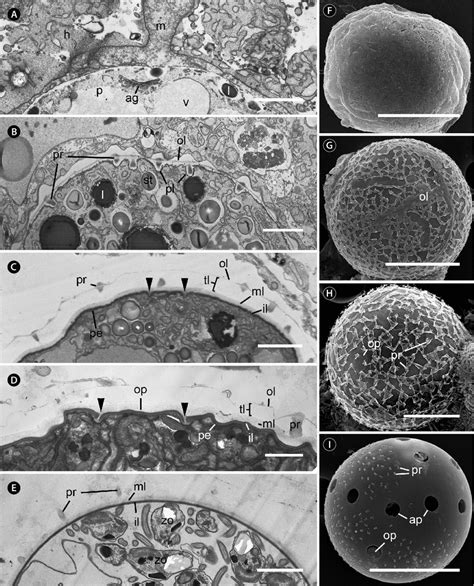 Transmission Electron Microscopy Cell