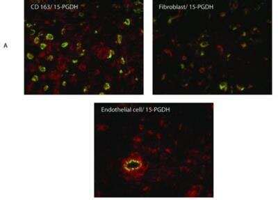 15 PGDH HPGD Antibody NB200 179 By Novus Part Of Bio Techne