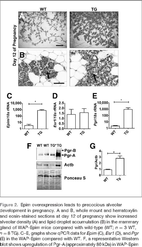 Figure From Molecular And Cellular Pathobiology Epimorphin Is A Novel