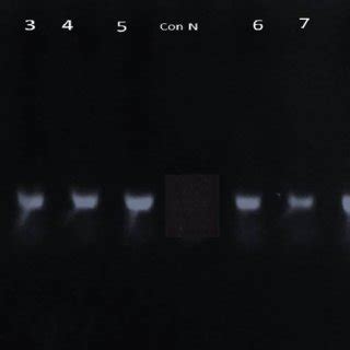 Gel electrophoresis represent the results of the PCR products on 1.5% ...