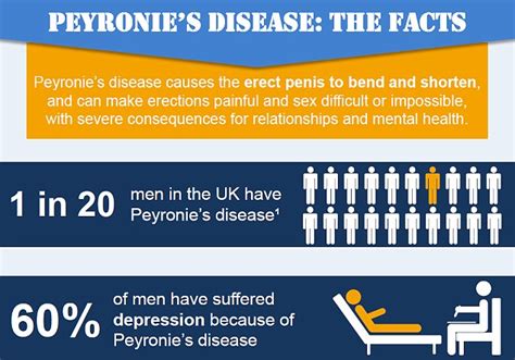 Peyronie S Disease The Condition That Affects Millions Of Men And Can Ruin Sex Lives Daily