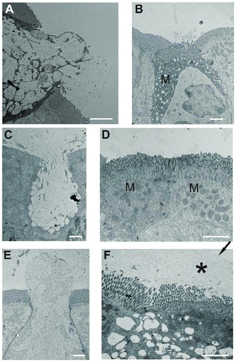 Transmission Electron Micrographs Of Mouse Rat And Human Peyers