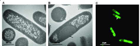 Intracellular Localization Of Fusion Proteins In E Coli A And B