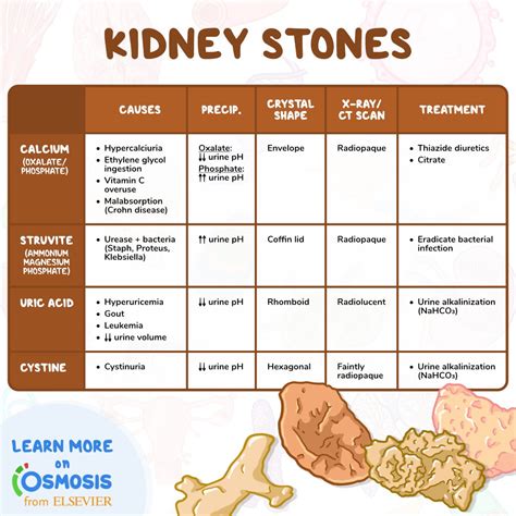 kidney stone color chart definition facts  kidney stones niddk