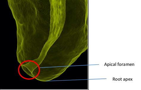 Apical Foramen