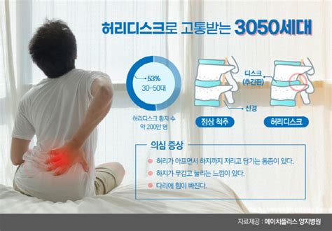 대한민국 3050세대 허리가 위험하다허리디스크 환자 53가 30~50대 매일경제