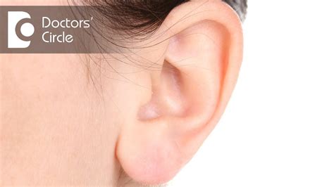 Pimple On The Earlobe: Treatments, Causes, And Prevention | atelier ...