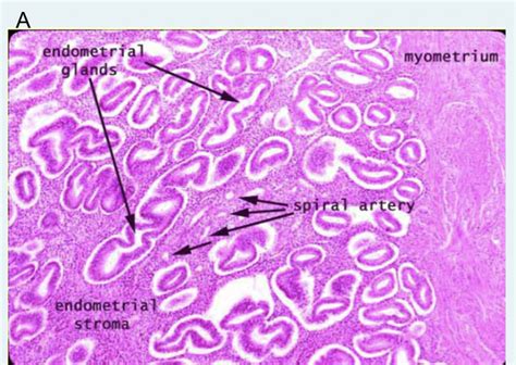 Solved The endometrial appearance in histology is very | Chegg.com