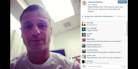 Photo L Acteur Am Ricain Benjamin Mckenzie Montre Sa Blessure Sur Le