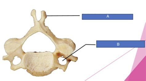 Axial Skeleton/ Vertebrae/ Cervical Flashcards | Quizlet