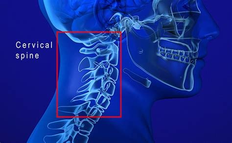 C3, C4, & C5 Vertebrae Spinal Cord Injury | SpinalCord.com