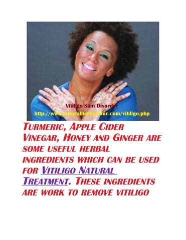 Treatment of vitiligo with natural herbs clinic,s herbal remedy by Natural Herbs Clinic - Issuu