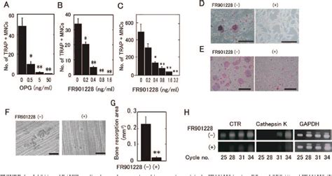 Figure From Production Inducing Ifn Osteoclastogenesis And Bone