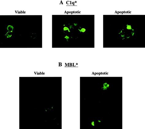 C1q And MBL Bind To The Surface Of Apoptotic Cells Both Jurkat T Cells