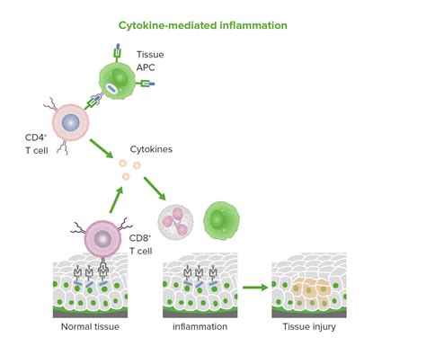 Type IV Hypersensitivity Reaction | Concise Medical Knowledge