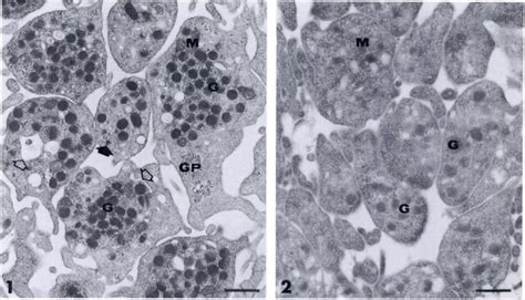 Figure 2 From Immunoelectron Microscopic Localization Of Platelet