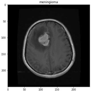 One sample image for each of the three types of tumor | Download ...