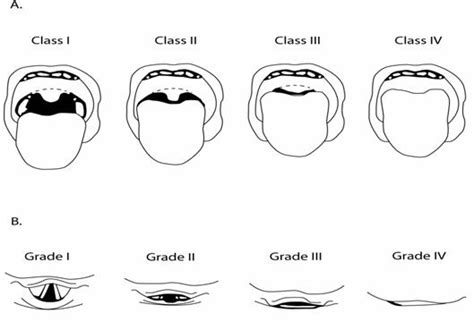 Traumagency Airway Assessment