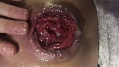 Moscow Anal And Vaginal Fisting Russian Porn XHamster