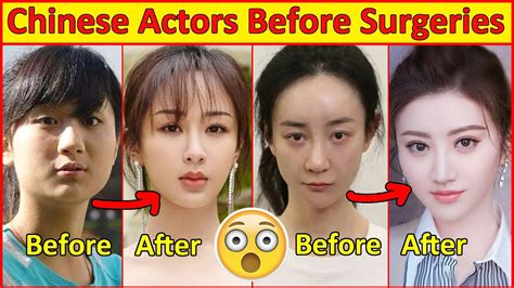 Chinese Actors Before And After Plastic Surgeries 😮 Incredible