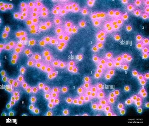 False Colour Transmission Electron Micrograph TEM Of Human