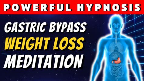 Gastric Bypass Hypnosis For Weight Loss Youtube