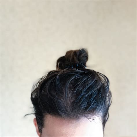 Why Does My Head Get Itchy When It S Oily - Infoupdate.org