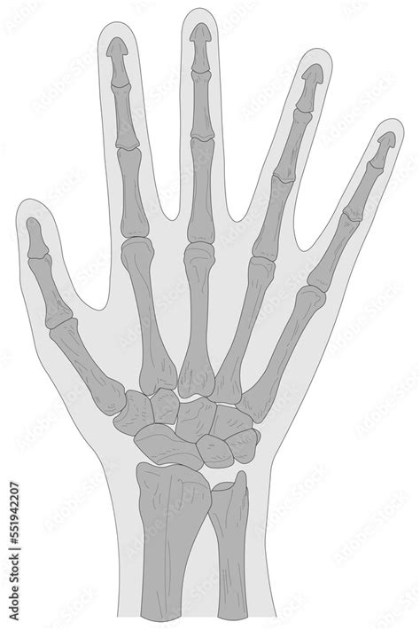 Bones of the right hand, dorsal (posterior) view Stock Illustration ...