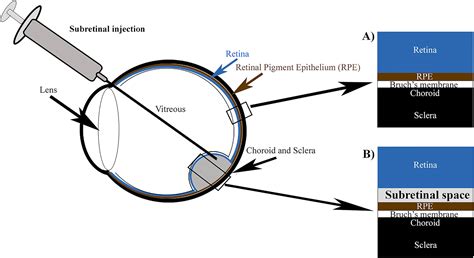 The Different Regions Of The Macula